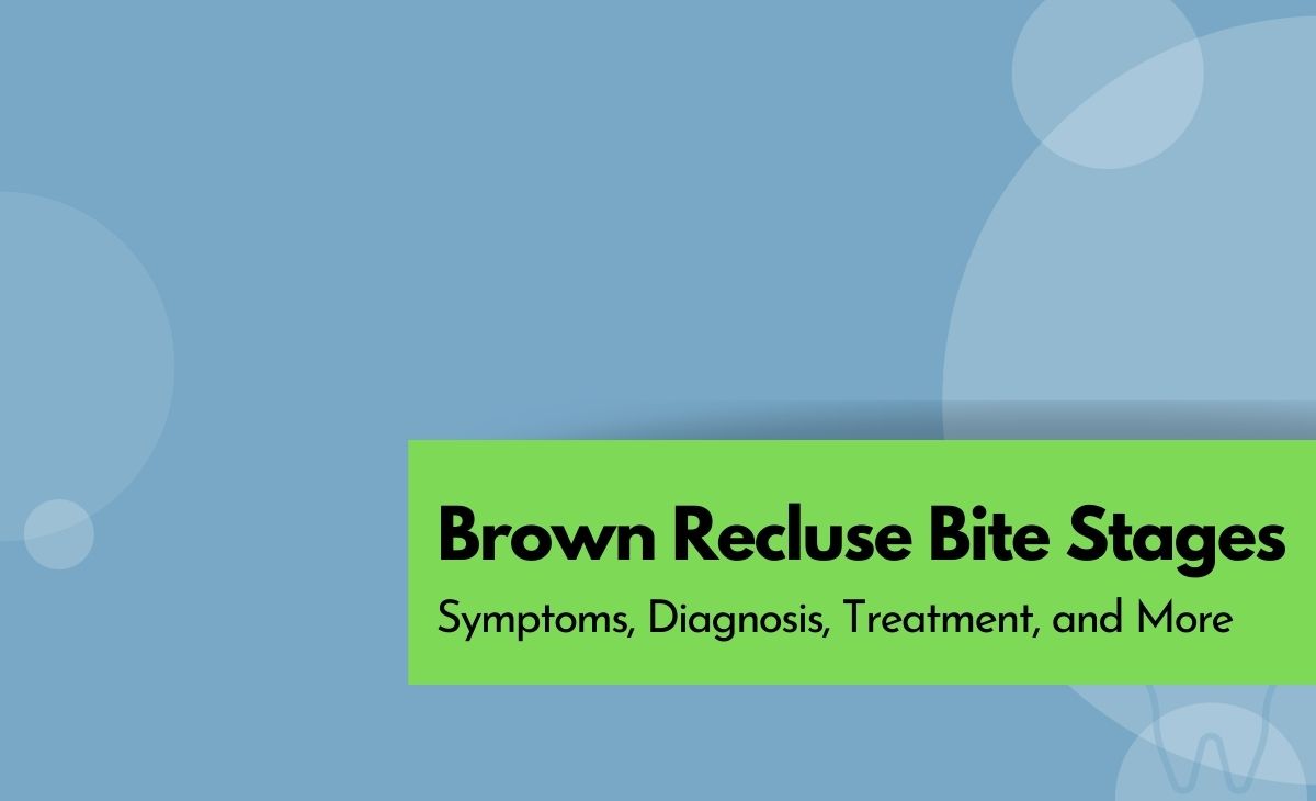 Brown Recluse Spider Bite: Stages, Symptoms and Treatment
