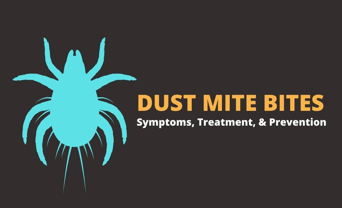 do i have dust mites