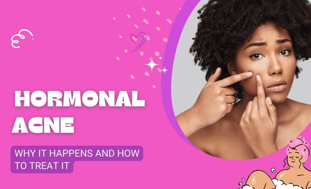 Hormonal Acne Why It Happens And How To Treat It Resurchify