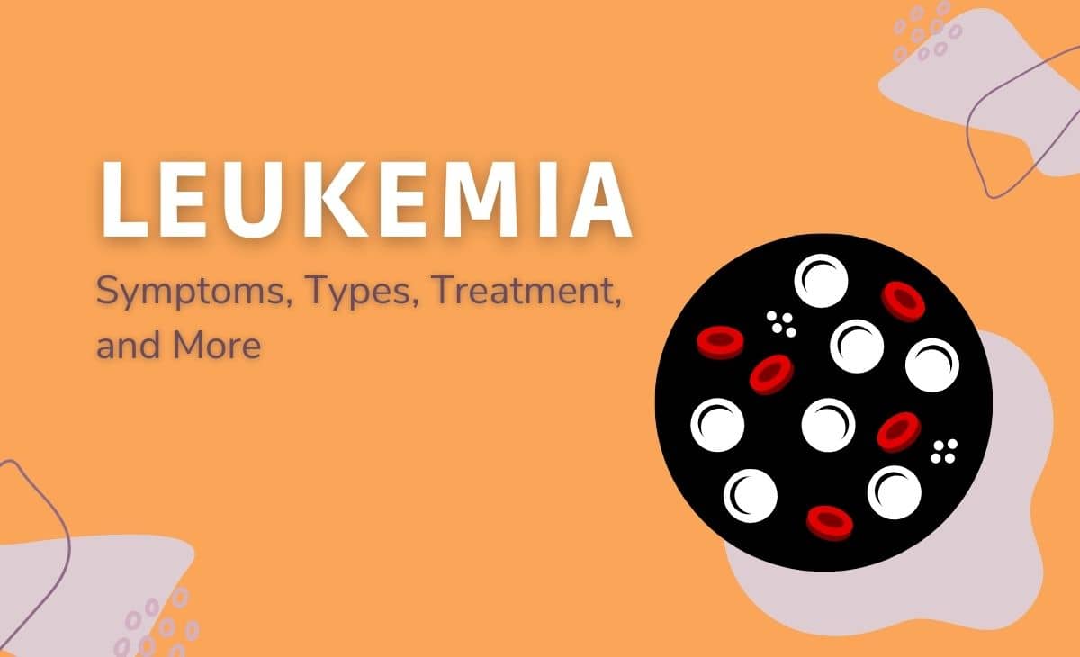 Leukemia: Symptoms, Types, Treatment, and More - Resurchify